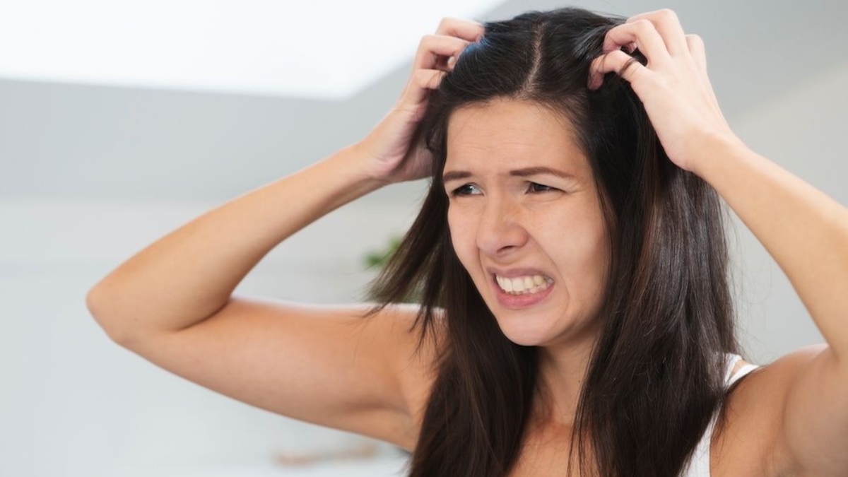 struggling with dandruff know how it affects your face