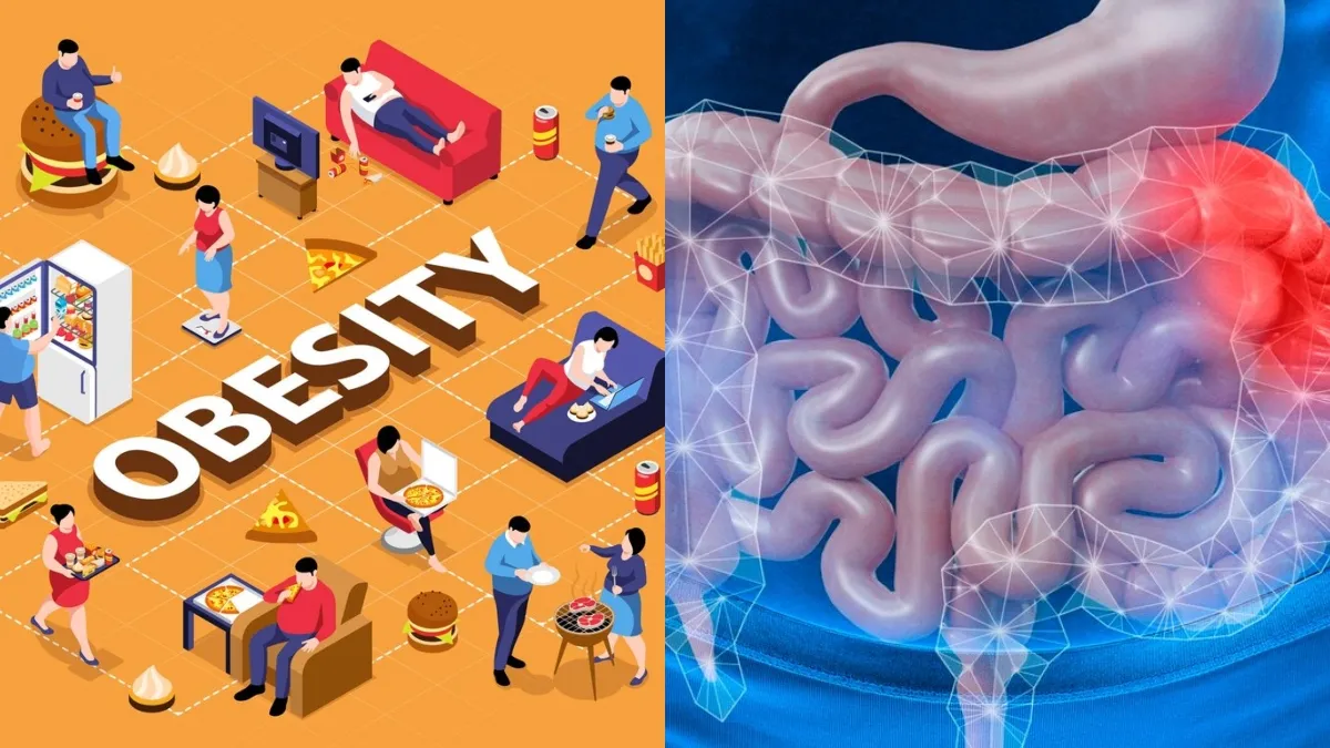 Know what is Gut Microbiome and its role in obesity.