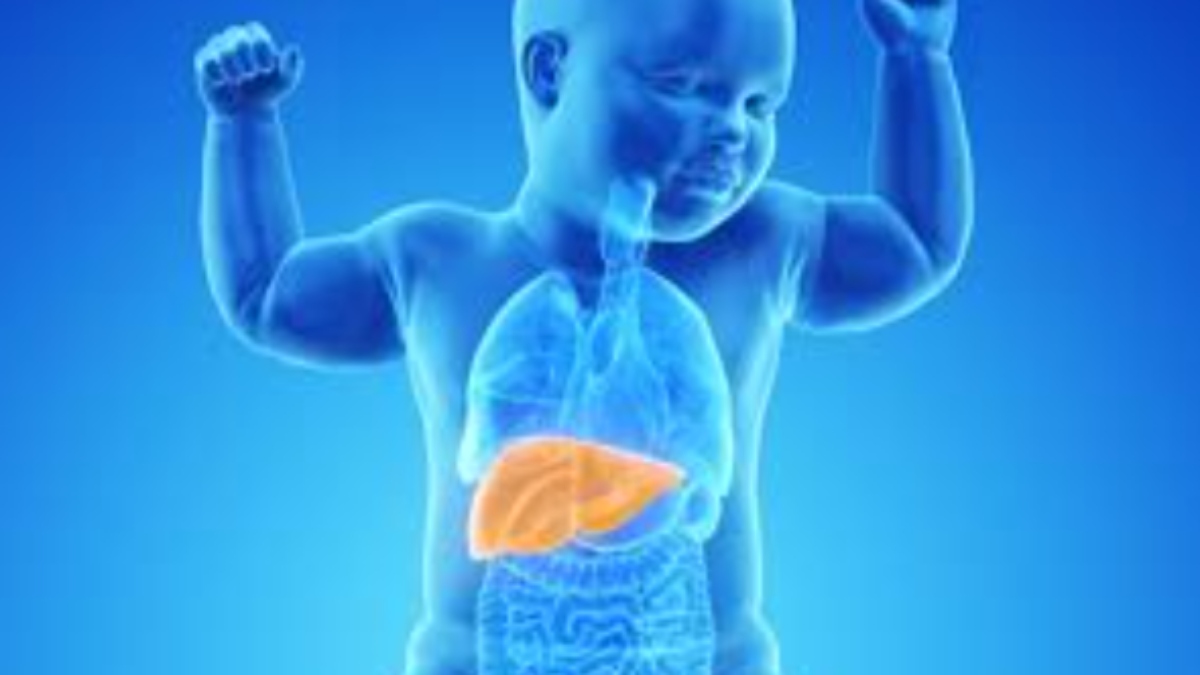 wold liver day 2024 what is iron overload know its effects on children s liver health