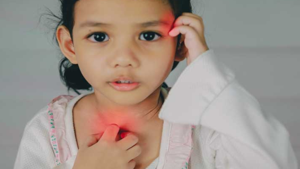 What Are The Causes Of Childhood Eczema? Know Preventing Tips For The 