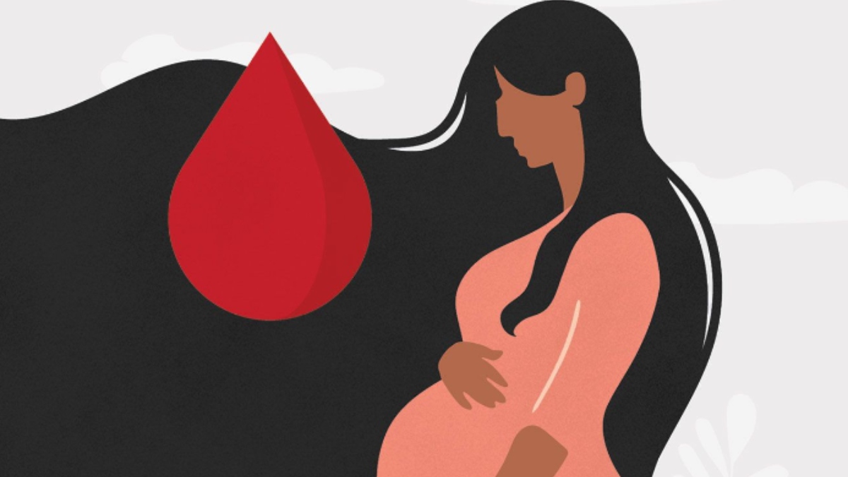 Severe Postpartum Haemorrhage: Tips for early recognition and preventive measures for blood loss