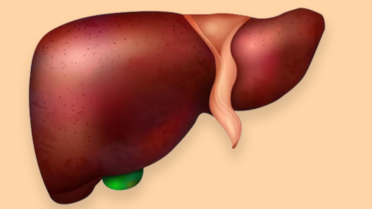 world liver day 2024 know why excess oil and sugar in foods equally bad as alcohol for liver