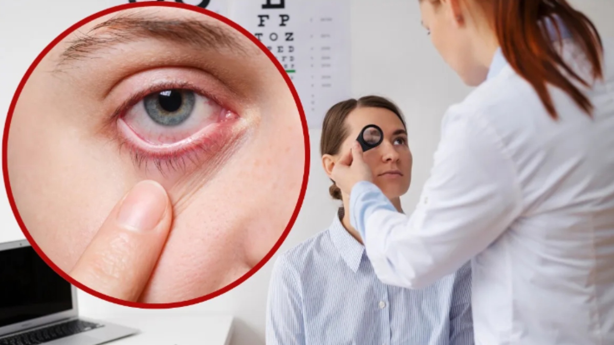 Risk of 'eye stroke' is increasing due to scorching heat, learn how to improve your eyesight