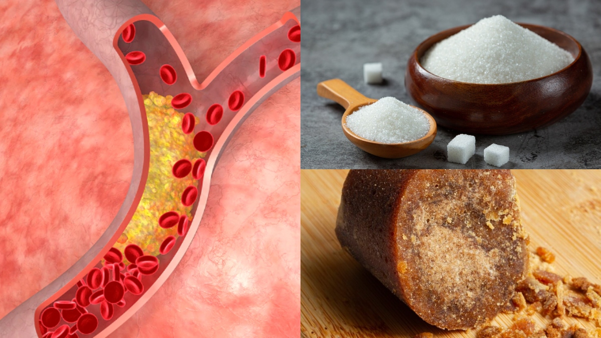 Should patients consume sugar or jaggery when cholesterol levels rise? Expert shares healthy option