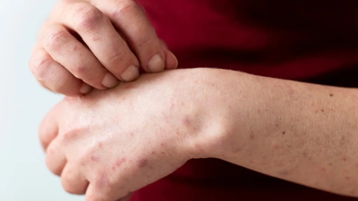 Body itching at night can be a sign of liver disease.