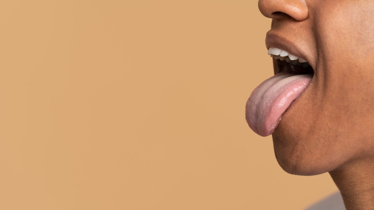 What is the colour of your tongue? Different colours can indicate some serious diseases