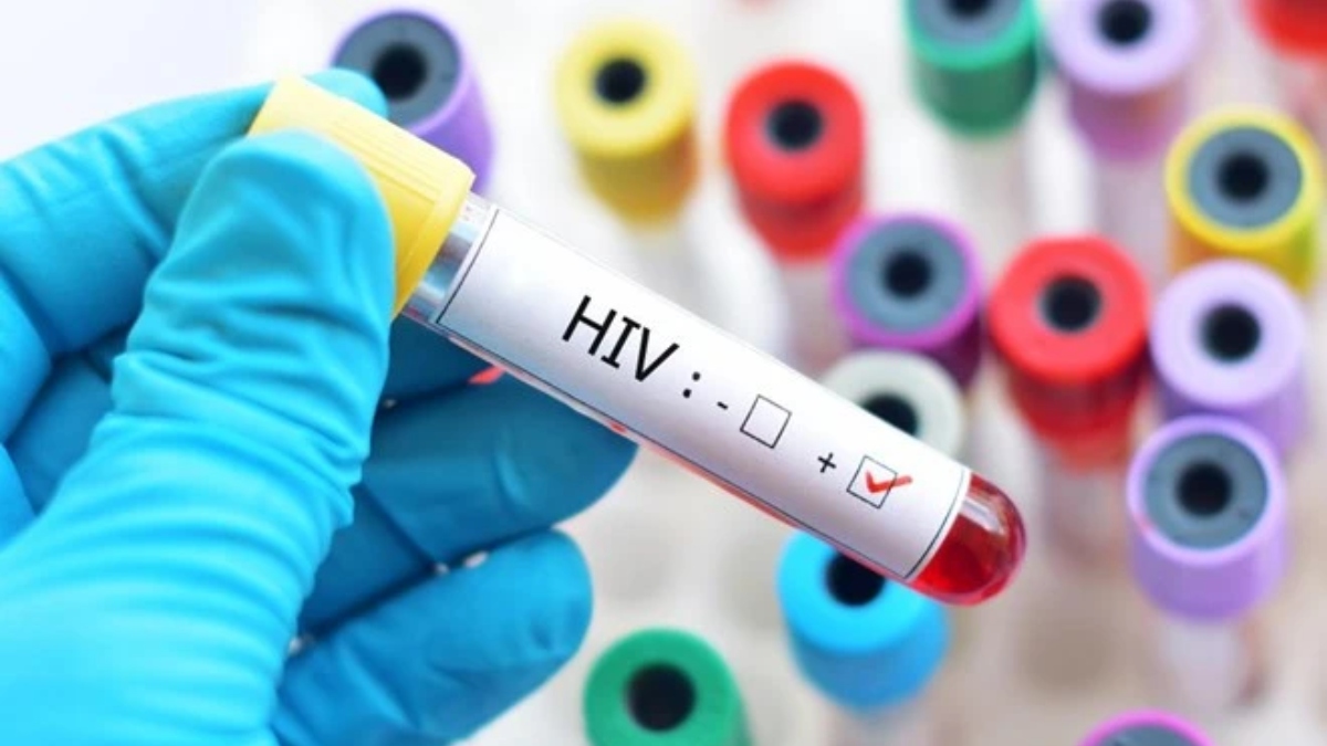 HIV Infection in Tripura: 828 students tested positive, 47 died; know causes and symptoms