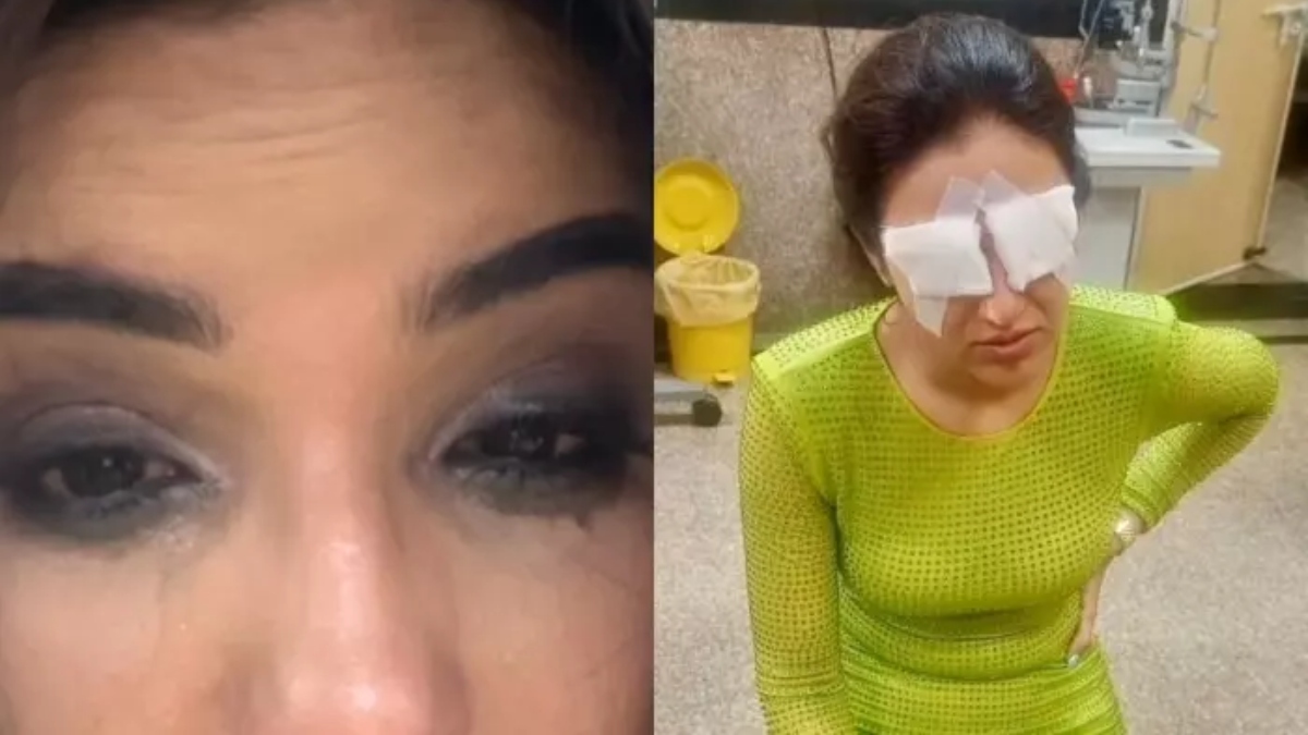 Jasmine Bhasin's eyes got damaged due to contact lenses; follow safety precautions to prevent Corneal Damage