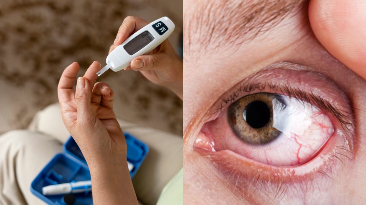 Diabetic Retinopathy: Know symptoms and prevention tips for this eye disease