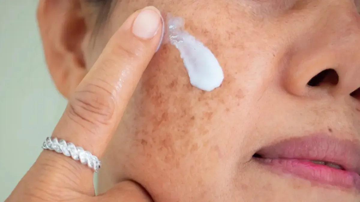 5 most common skin concerns faced during pregnancy