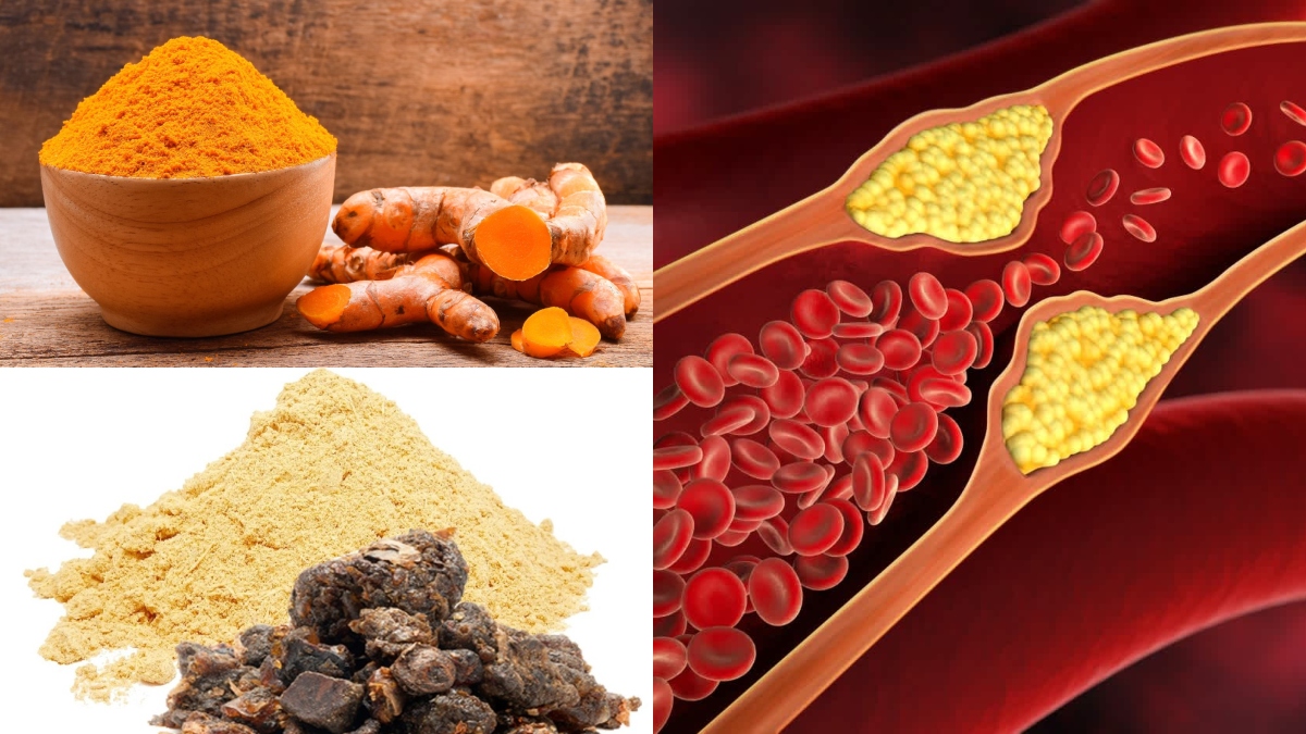 Turmeric to Guggul: 5 ayurvedic spices to flush out Bad LDL Cholesterol naturally without medication