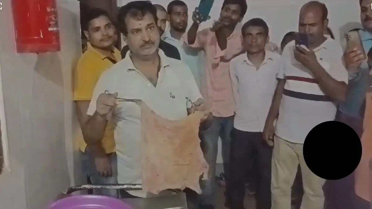 Bihar hospital negligence: Cloth left in woman's stomach during delivery.