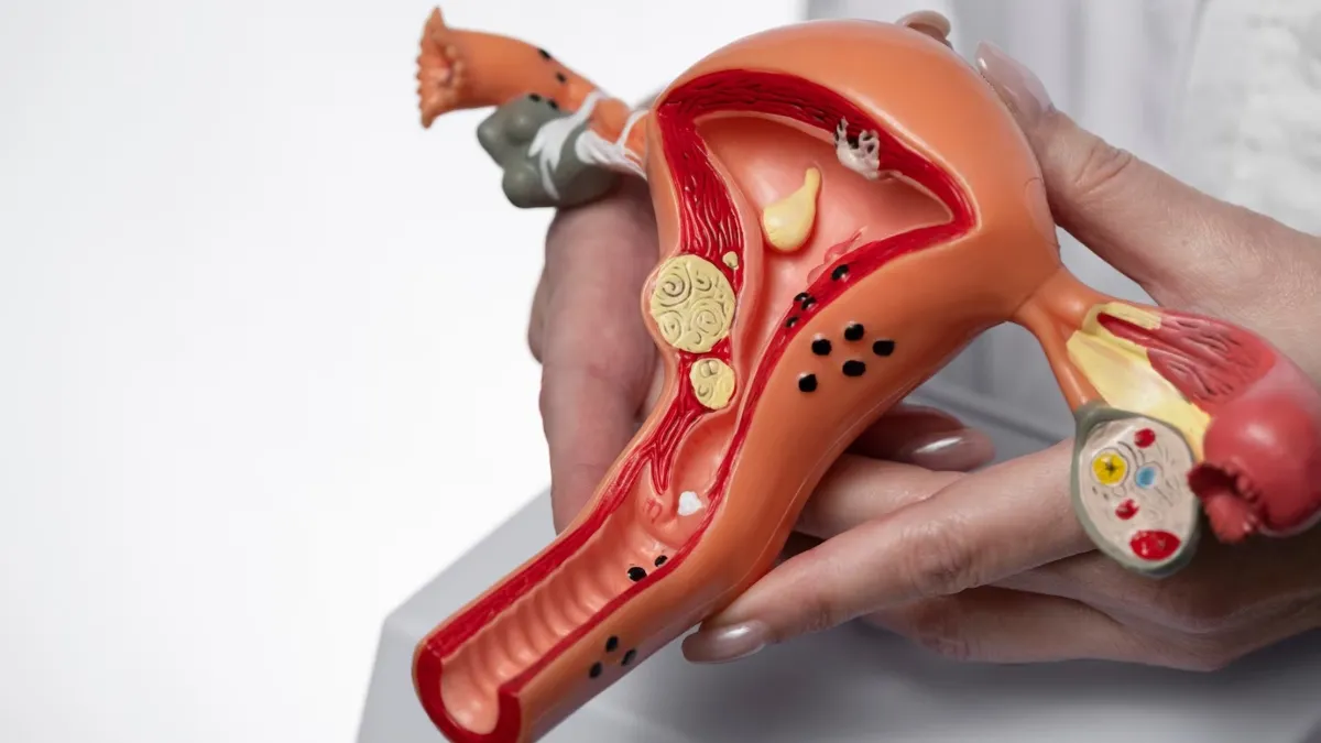 Researchers aim to identify biomarkers that could help in early detection of cervical cancer.