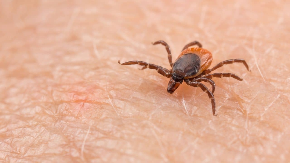 What is Wetland Virus? Know causes, symptoms and more about this new tick-borne virus discovered in China