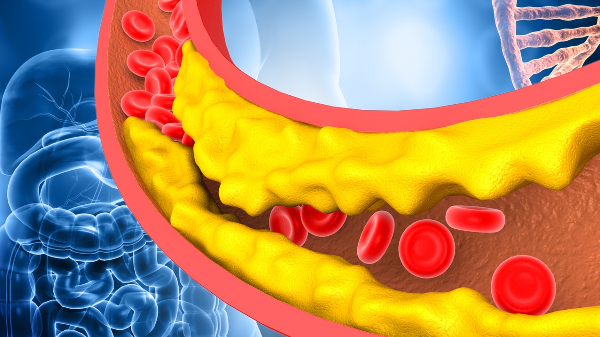 Say goodbye to dirty cholesterol buildup in veins with THESE 5 home remedies, know right way to consume it