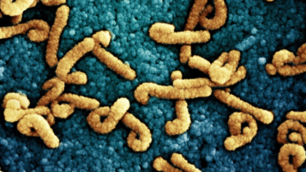 Marburg virus killed over 12 in Rwanda: Know symptoms, causes and more ...