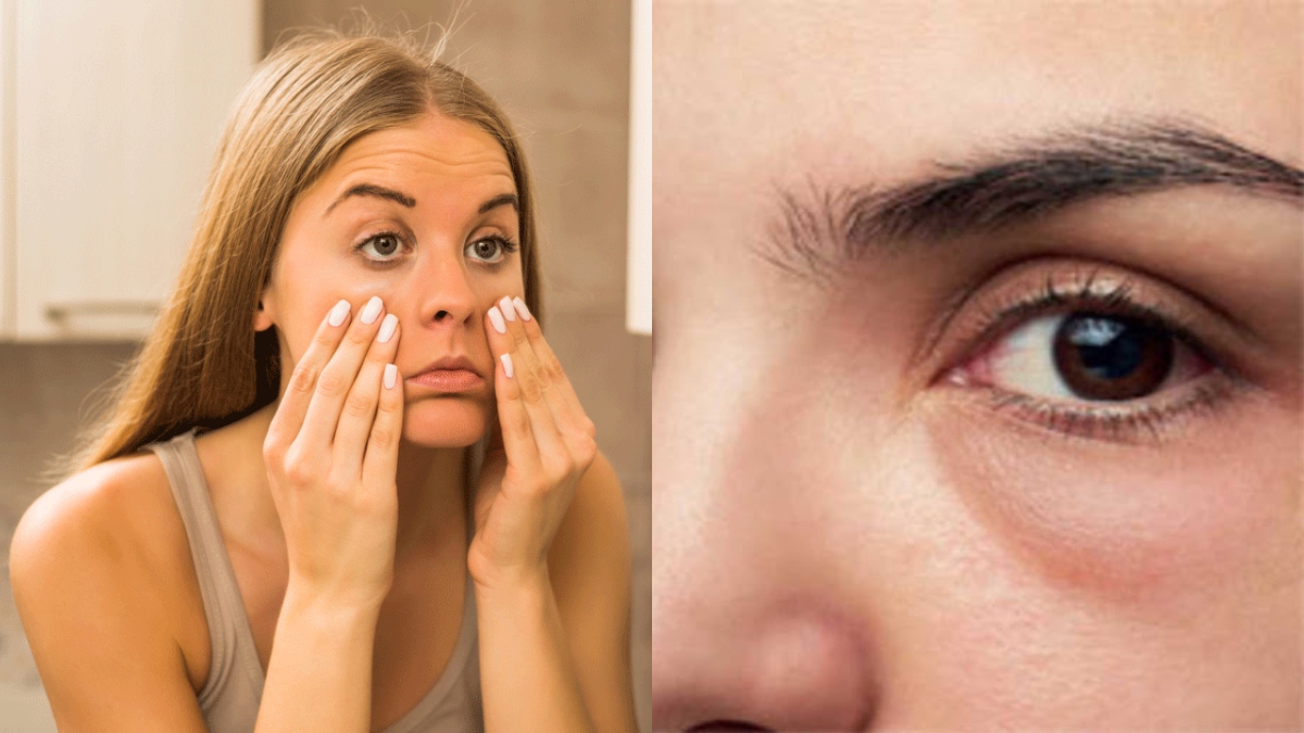 Wake up with swollen eyes during winter season? Here's 5 tips to reduce puffiness