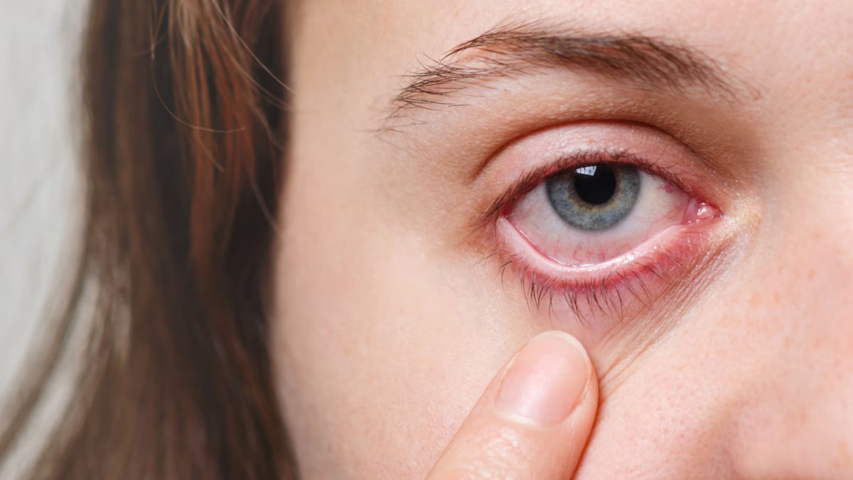 Common eye diseases worsened by pollution and how to prevent them