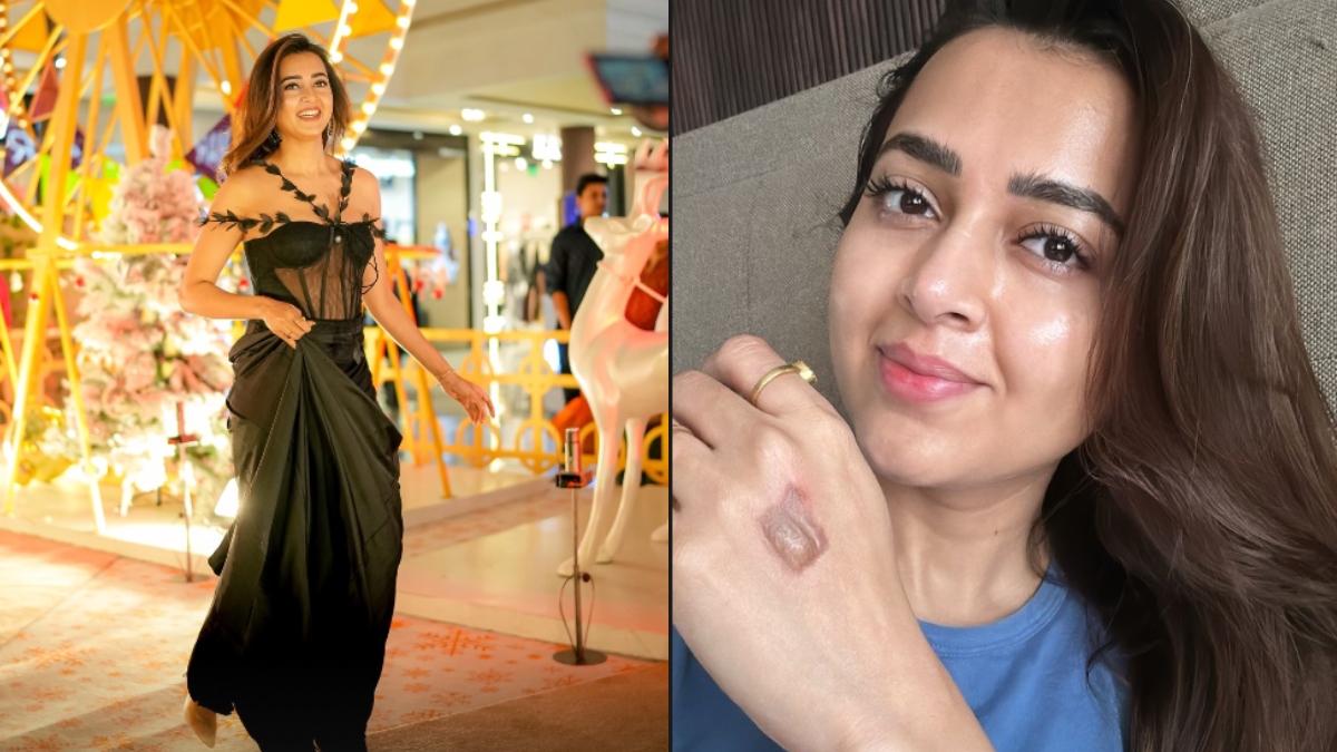 TV actor Tejasswi Prakash injured on sets of Celebrity MasterChef | See Photos