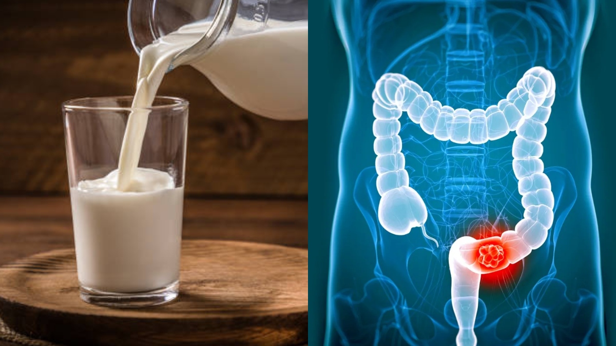 Drinking a glass of milk daily can help reduce risk of colorectal cancer, says study