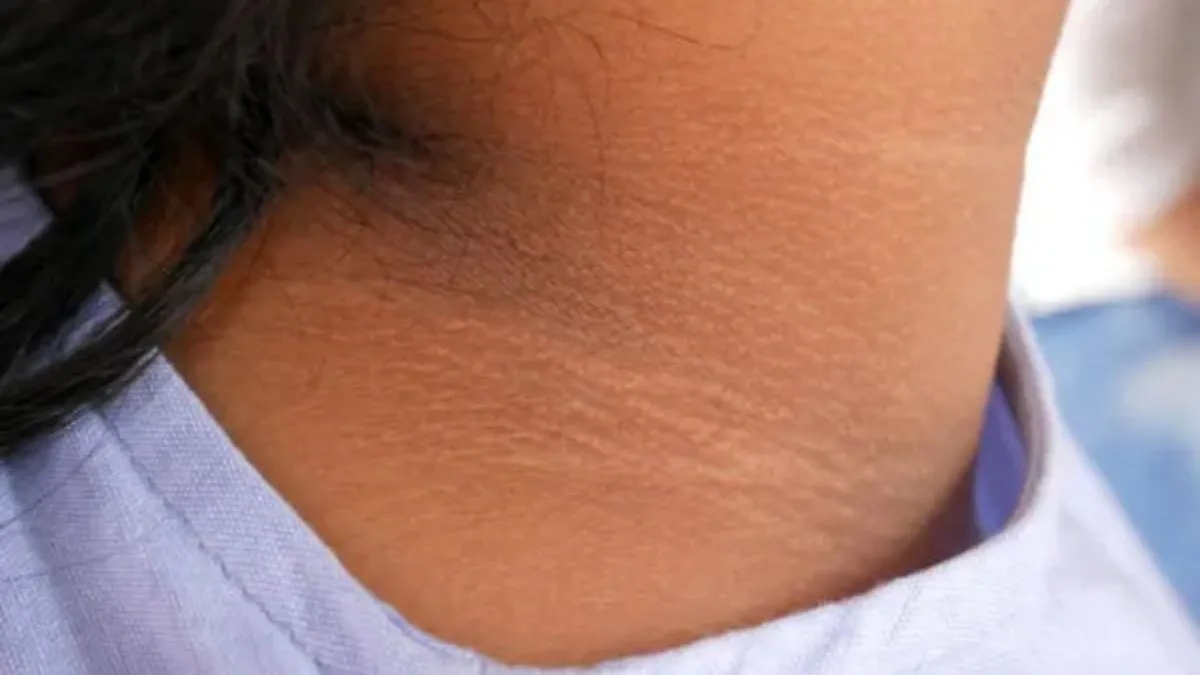 lifestyle dark neck issue try these amazing home remedies to get rid of pigmentation