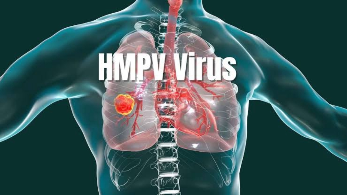 How is HMPV different from Covid? Know causes, symptoms and treatment