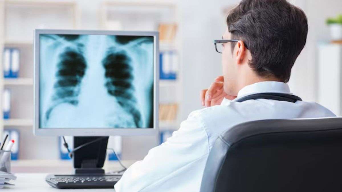 health lung cancer symptoms 6 early signs of the disease that can help in early diagnosis