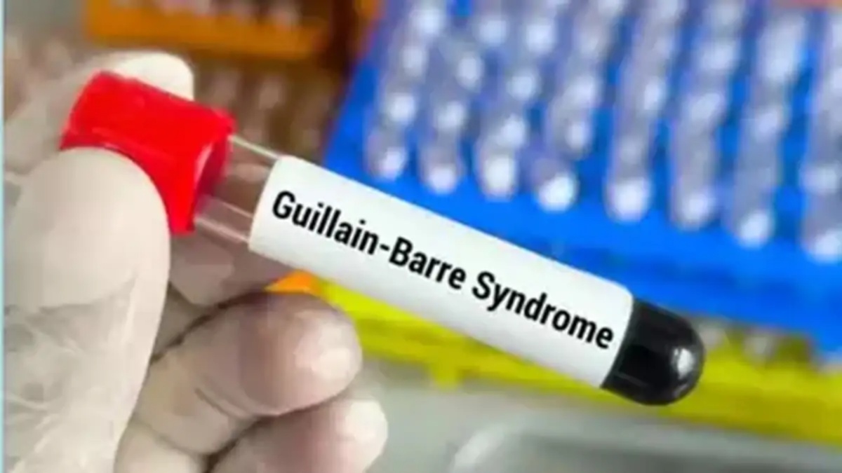 Maharashtra reports 167 Guillain-Barre Syndrome cases, 7 deaths suspected