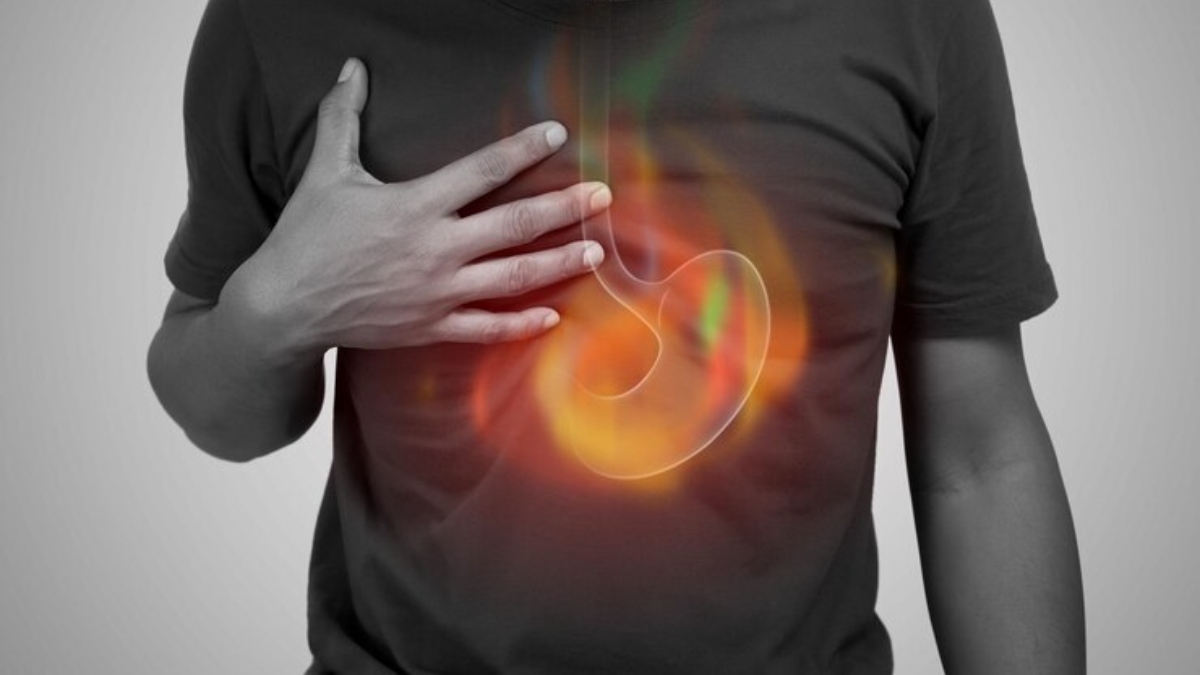 Acid reflux and GERD: Learn about doctor-recommended lifestyle changes to help lower them