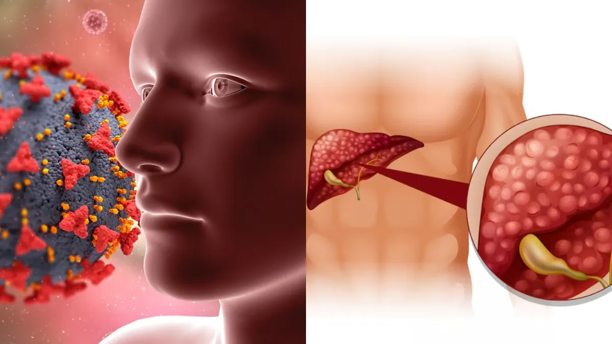 WHO declares Hepatitis D a cancer threat