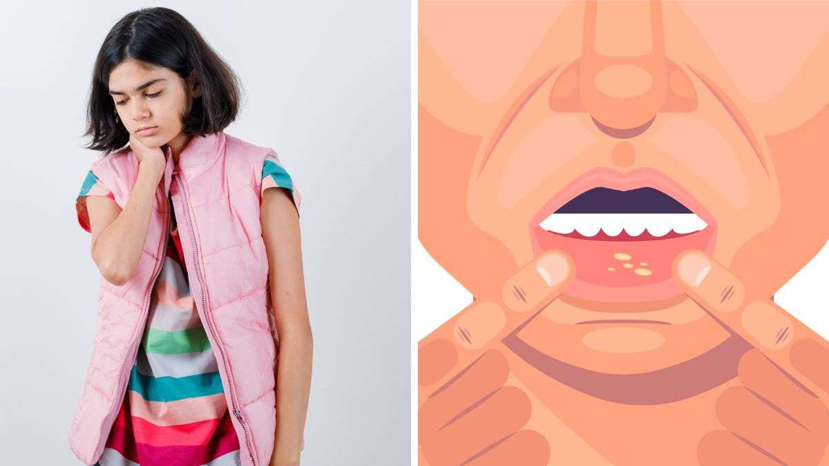 Stay Safe: Hand, Foot, and Mouth Disease in Delhi NCR