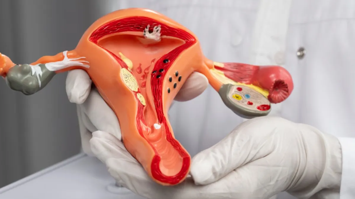 Menstrual tracking helps women with PCOS recognise symptoms and manage hormonal health.