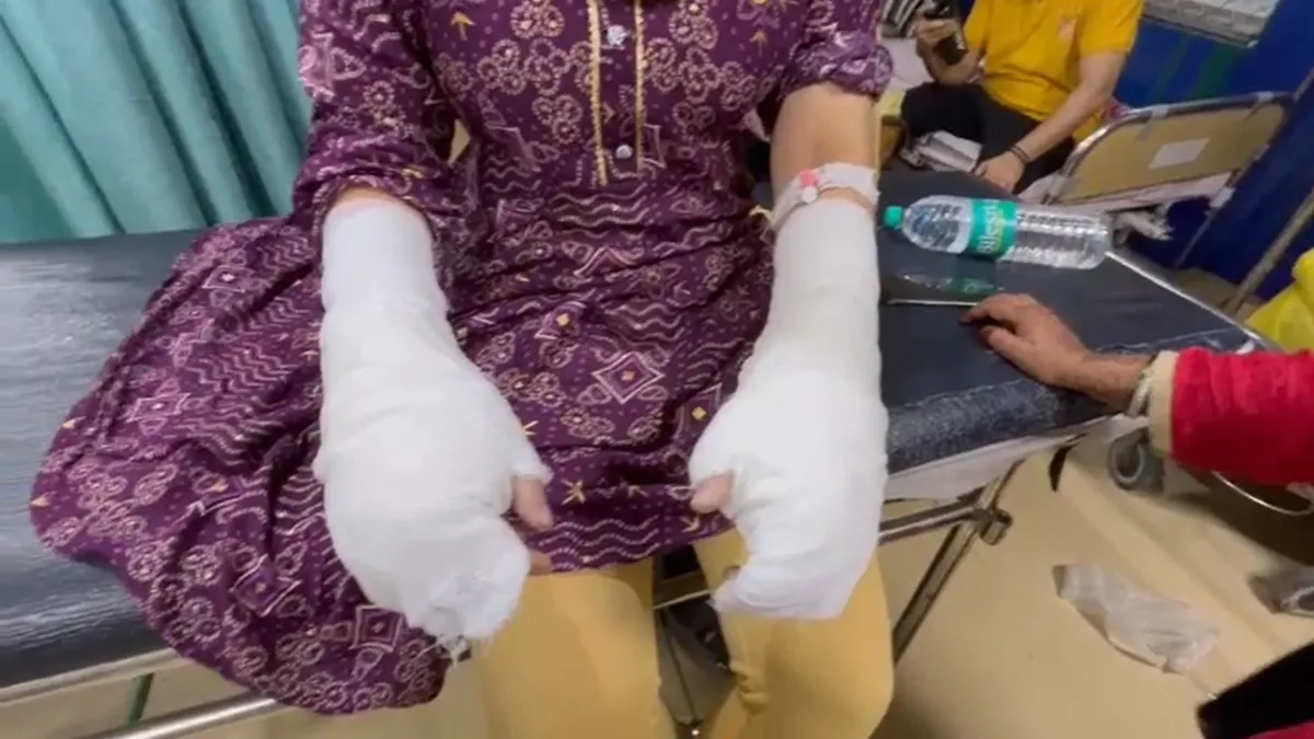 Acid attack survivor