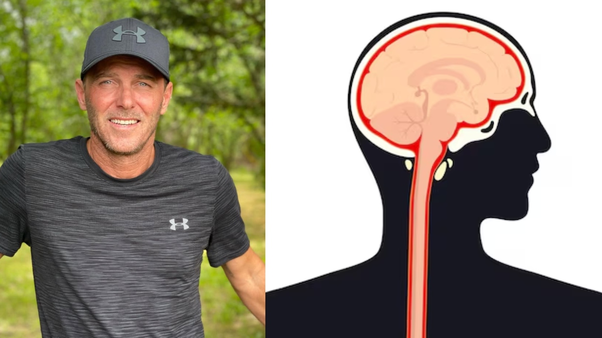 Meningitis: Understanding Symptoms and Risks