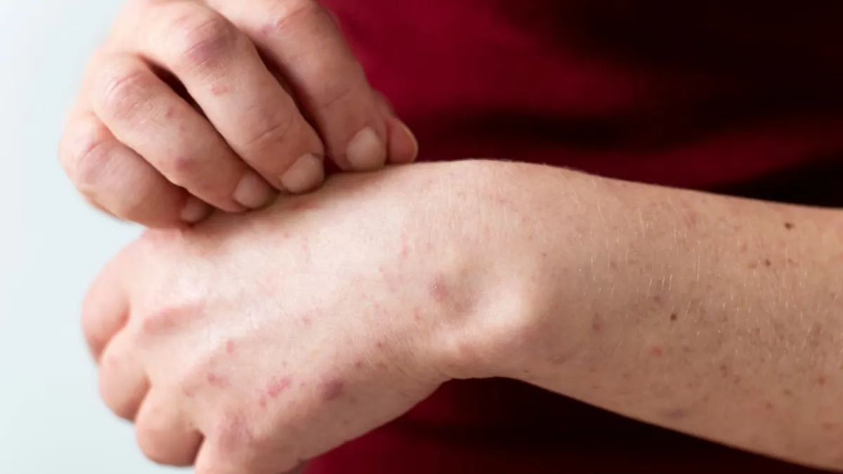 Know why Mumbai’s corporate workforce faces skin stress.