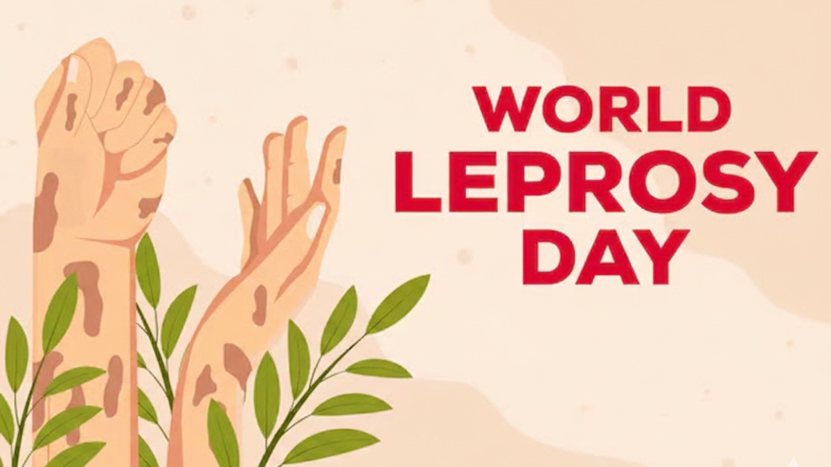 Busting Myths About Leprosy on World Leprosy Day