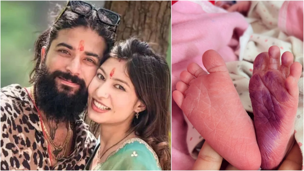 UK07 Rider aka Anurag Dobhal welcomes first child after recent car crash; wife Ritika Chauhan shares news