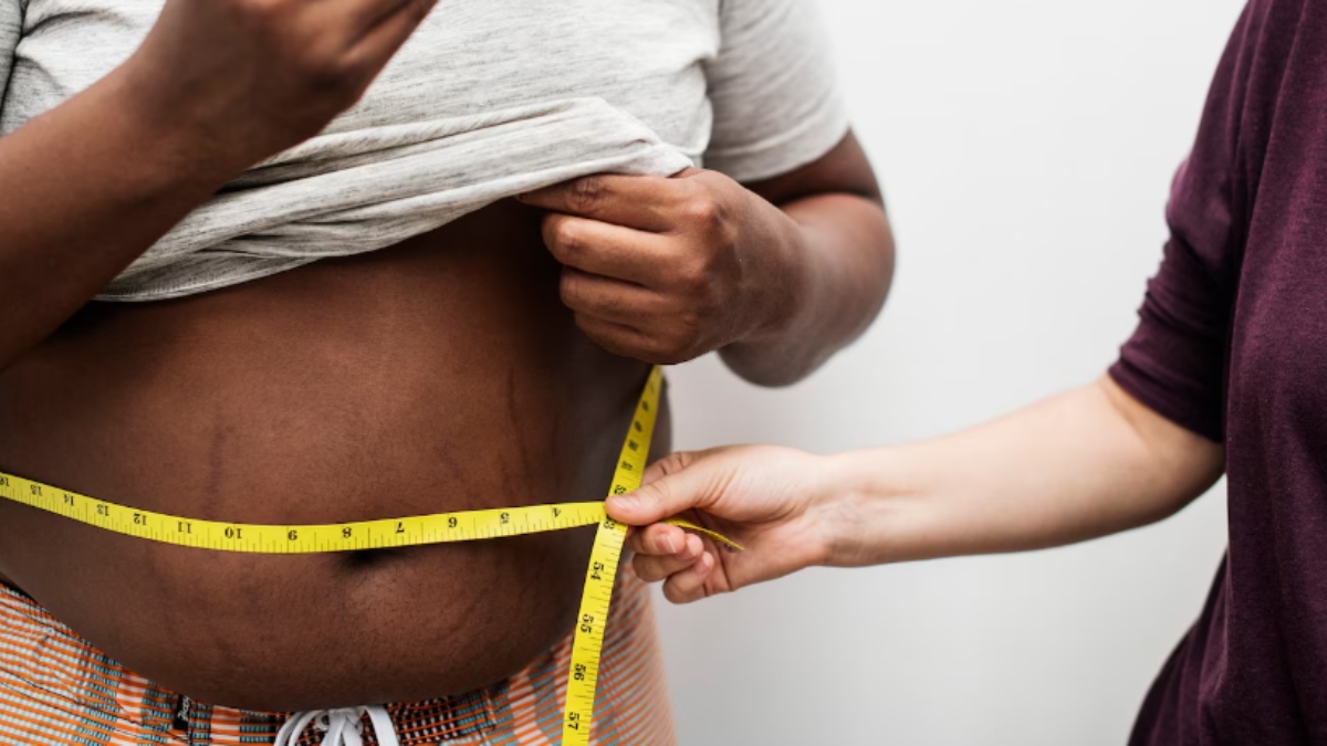 Obesity-related cancers on the rise: Causes, risks and prevention