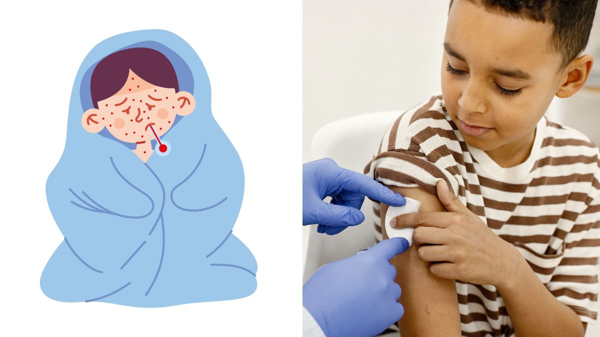 Bangladesh measles outbreak: Infectious Diseases specialist explains why India must stay alert