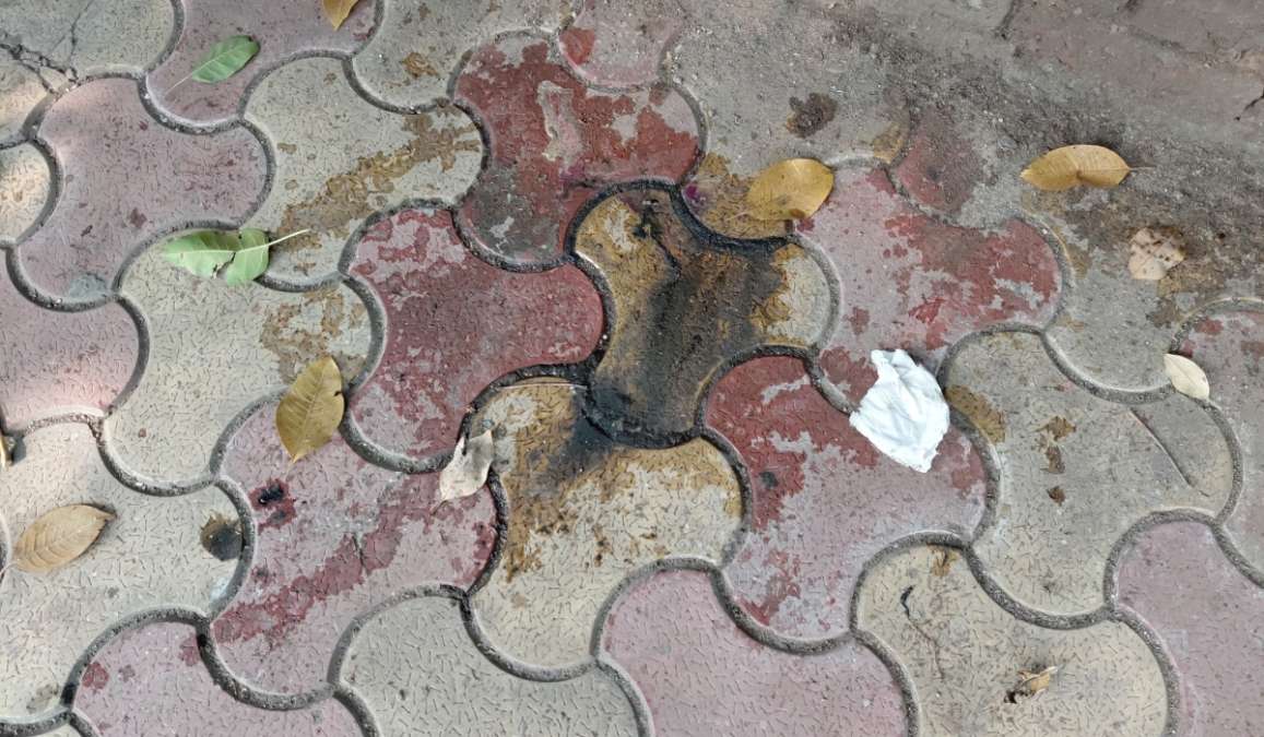 Acid Attack Horror Near Delhi University: DU Student Targeted Outside Laxmibai College, Police Hunt for Culprits
