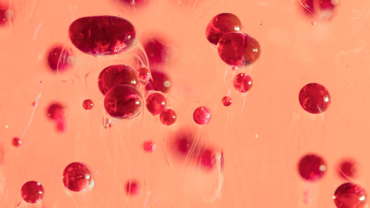 Low Haemoglobin: Doctor Reveals Hidden Health Dangers You Must Know