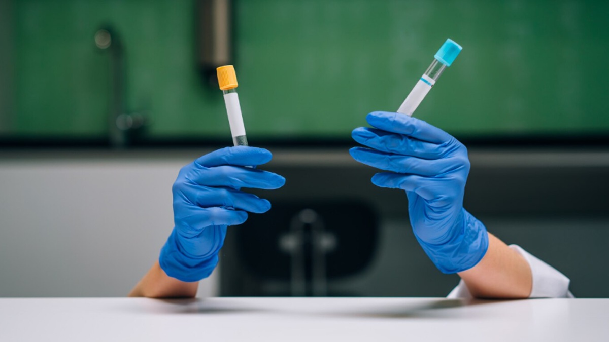 Gandhinagar Typhoid Outbreak: 3,000 Water Samples Tested, CM Reviews Crisis