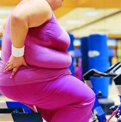 obesity arthritis women