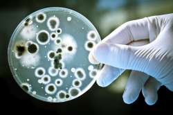 Representative image of bacteria