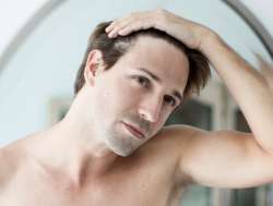 male pattern baldness heart disease 