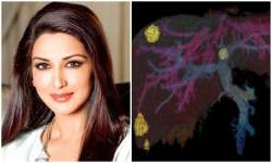 Sonali Bendre Cancer