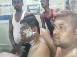 Karnataka local body elections: Congress candidate injured in suspected acid attack on victory march