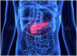 Pancreatic Cancer: Sign, Symptoms and Causes; Excess body weight may lead to this cancer