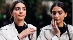 Sonam Kapoor reveals she has Iodine Deficiency