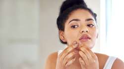 Tired of stubborn acne? Poor dietary habits, harsh skincare routine may be the reason...